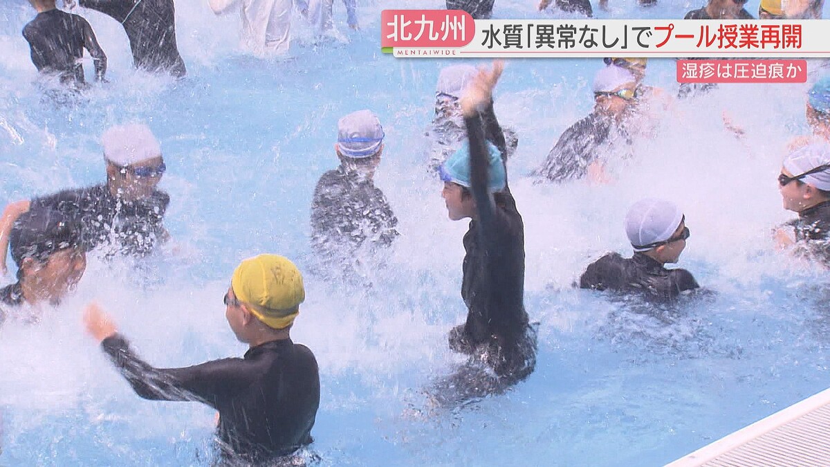北九州市で水泳の授業が再開、湿疹など訴えた小学校は外部のプールで授業
