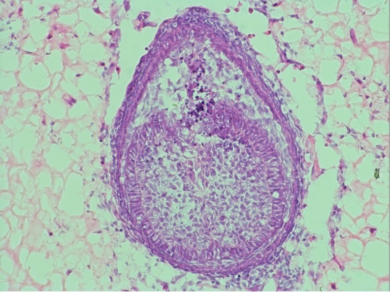 ヒトの歯を培養する研究、実用化に向け前進