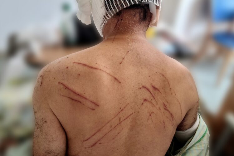 「物凄いスピードで追いかけてきて」クマに襲われた68歳男性、一部始終語る