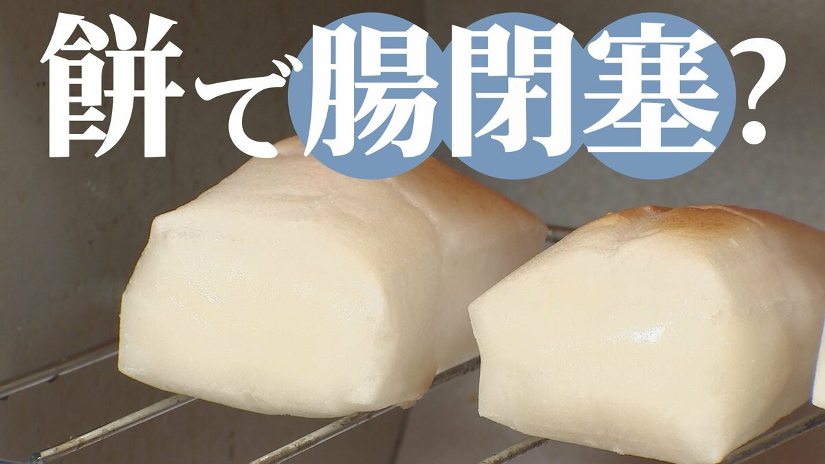 餅で腸閉塞→即入院→10日断食