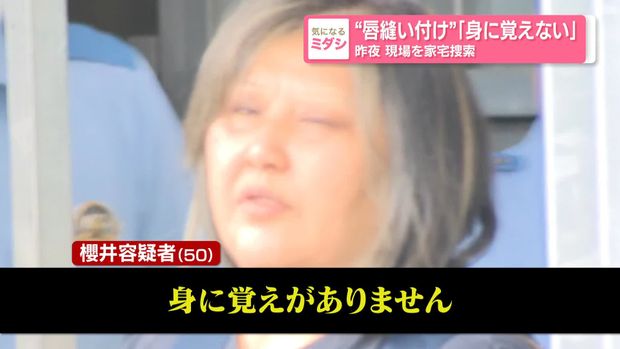 同居女性の唇を縫い合わせたか 逮捕の50歳女「身に覚えがない」